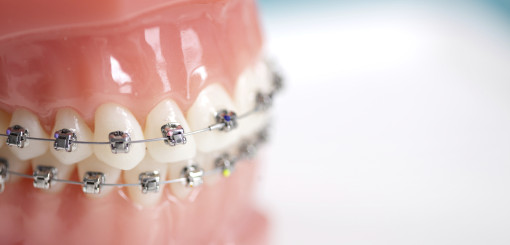 Orthodontics Dentistry