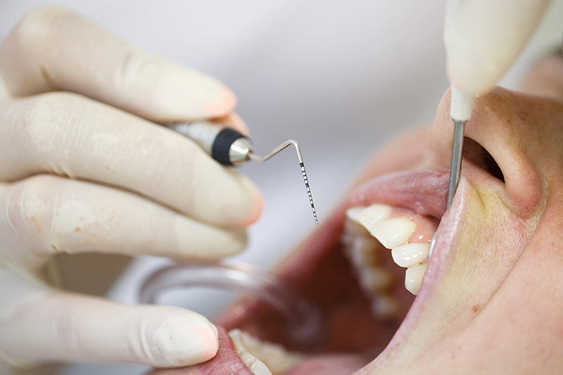 Periodontics Dentistry